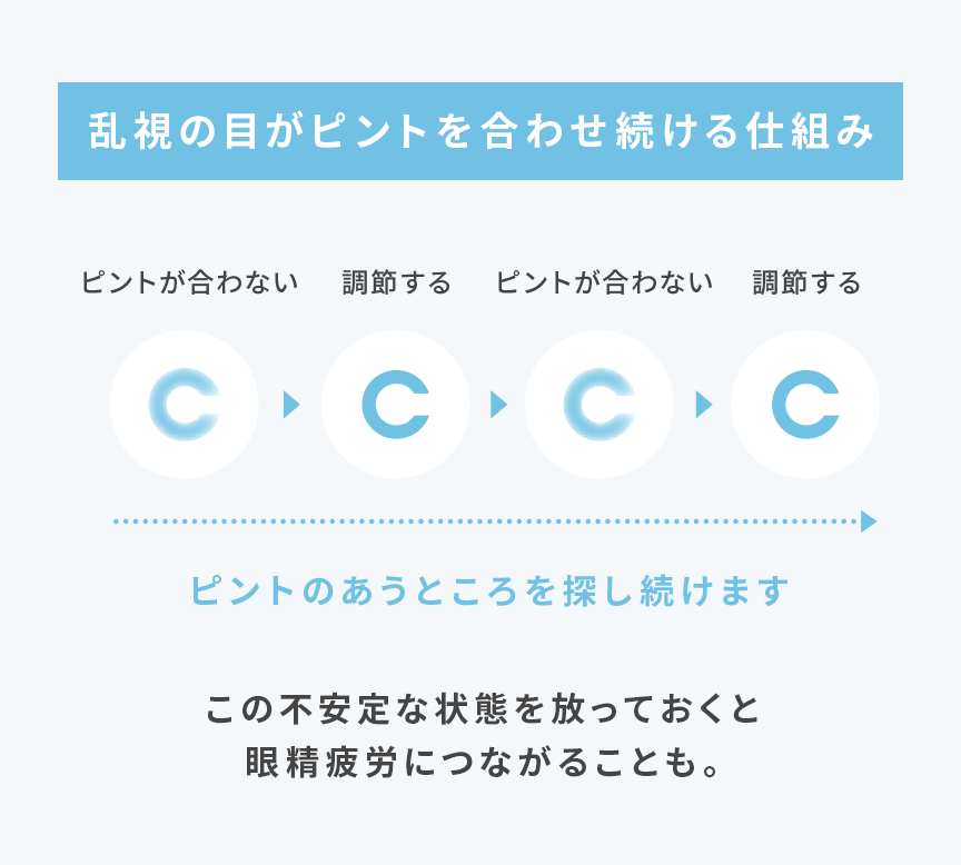 乱視について コンタクトレンズ通販レンズアップル